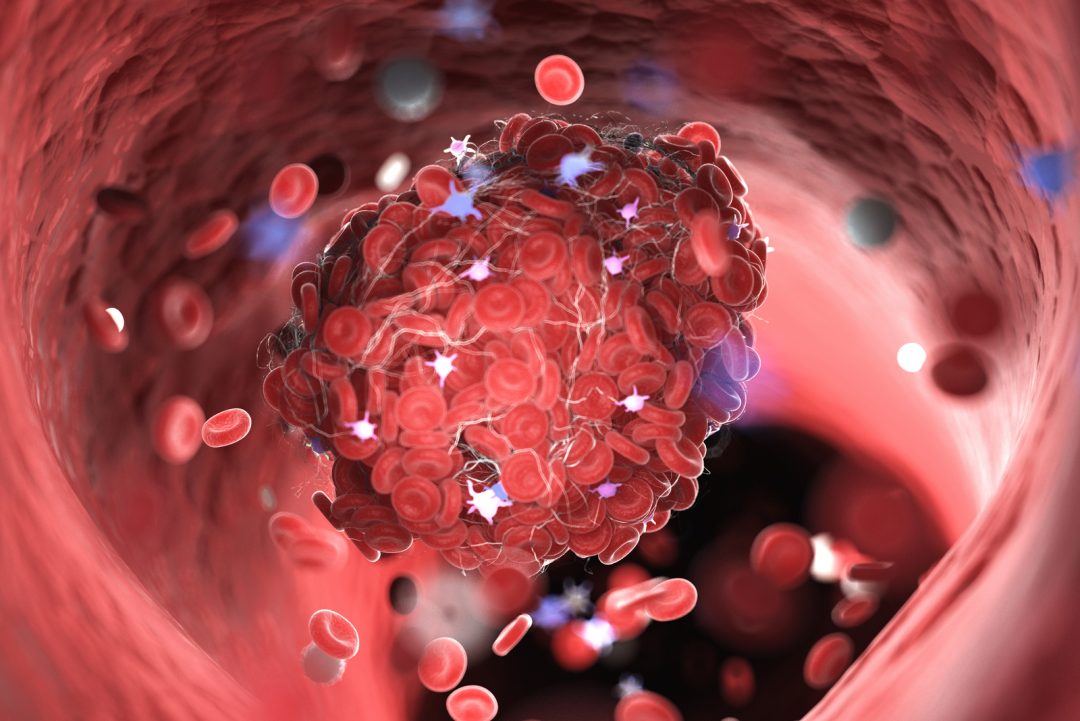 Cats’ Blood Clots What Does It Mean To Throw A Clot?