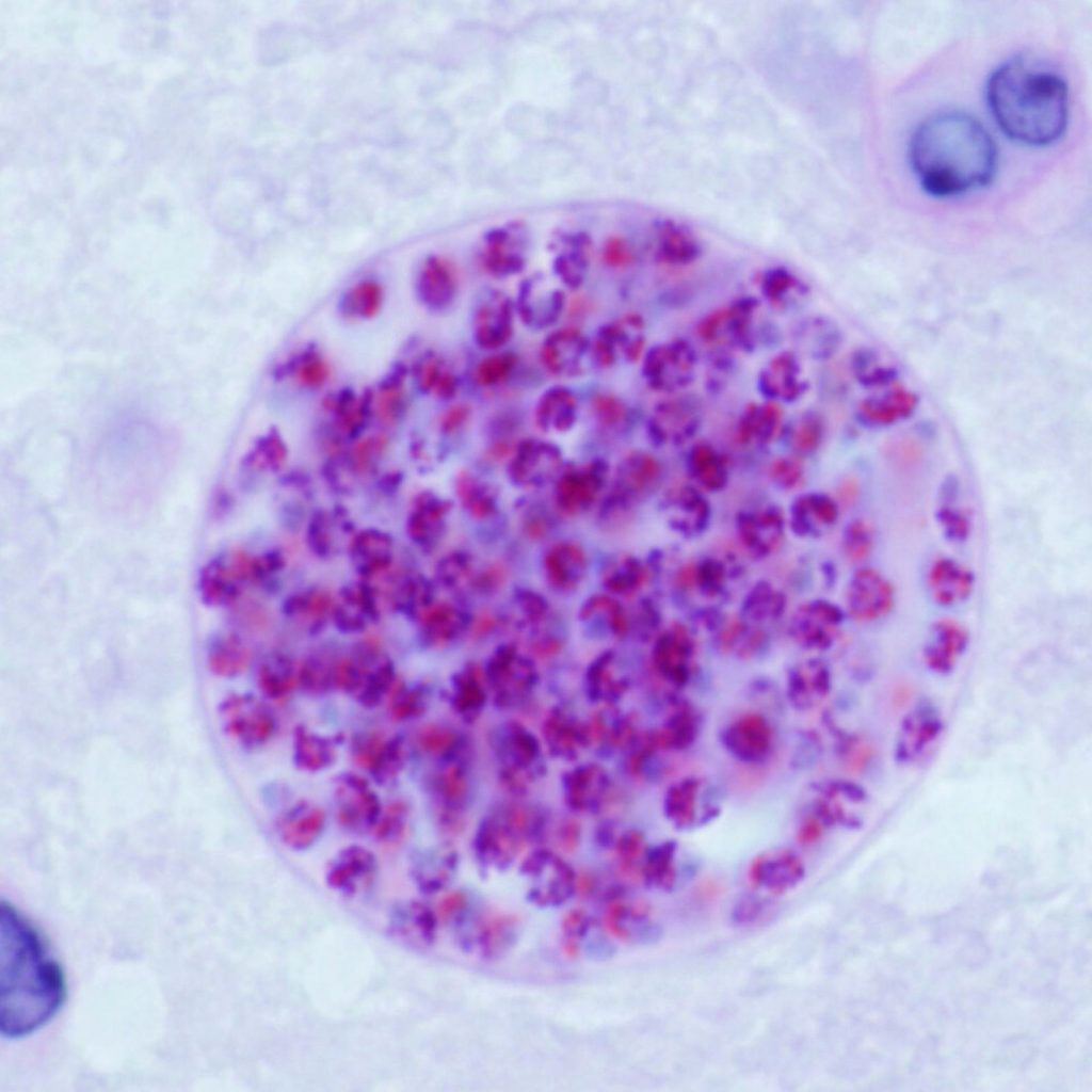 parasites under the microscope