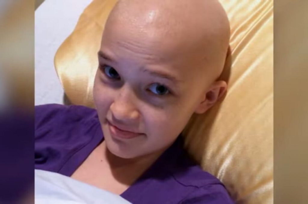 a beautiful girl without hair