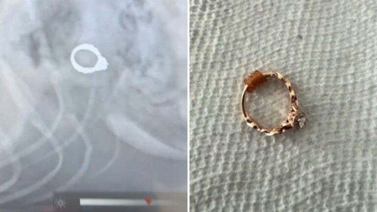 dog swallows owners engagement ring