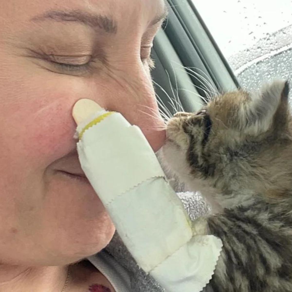 kitten with injured paws kissing woman