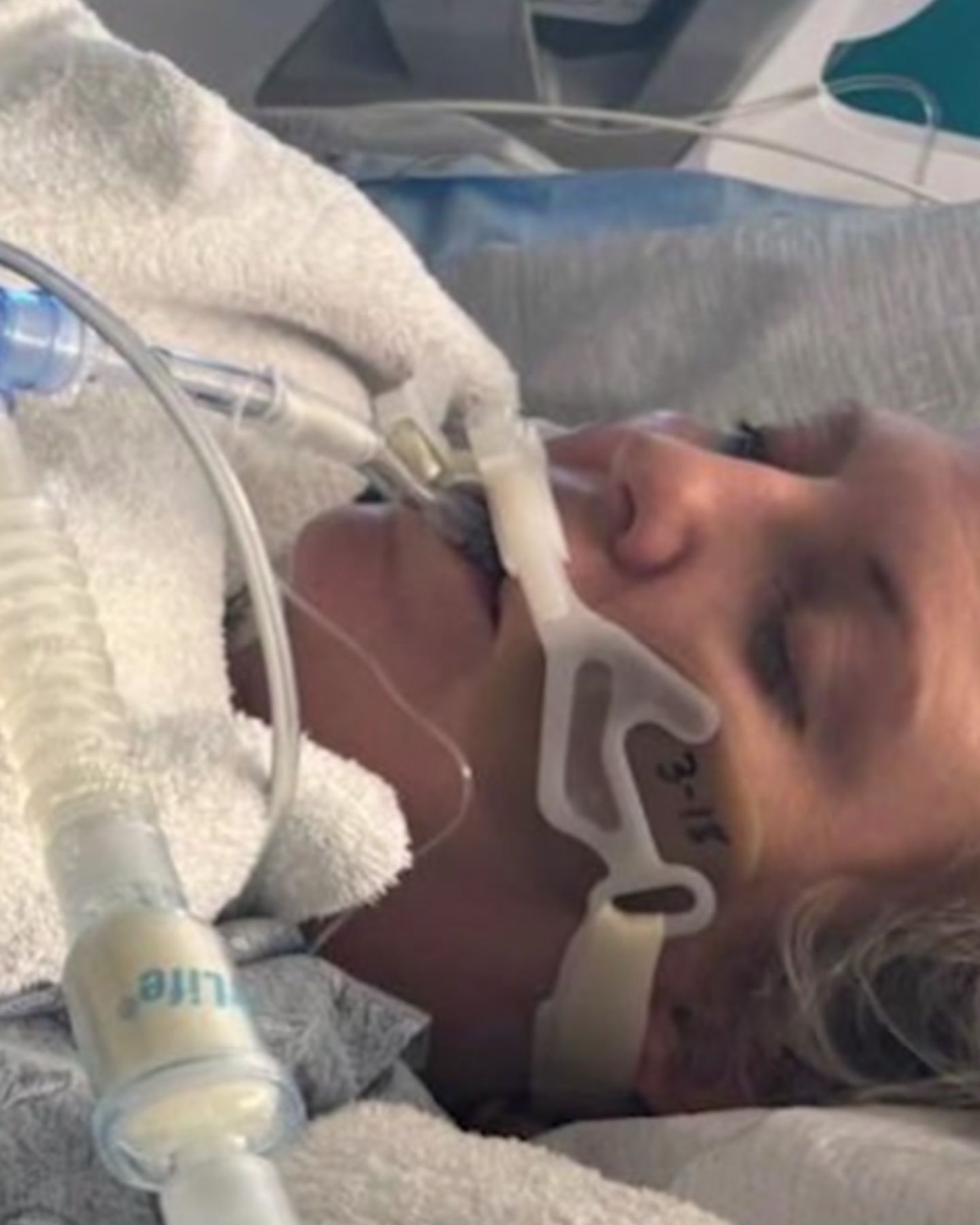woman wakes up from coma
