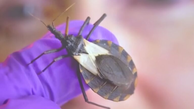 Fatal ‘Kissing Bug’ Disease Found In 32 U.S. States Is Now Endemic And 8 Million People Have It