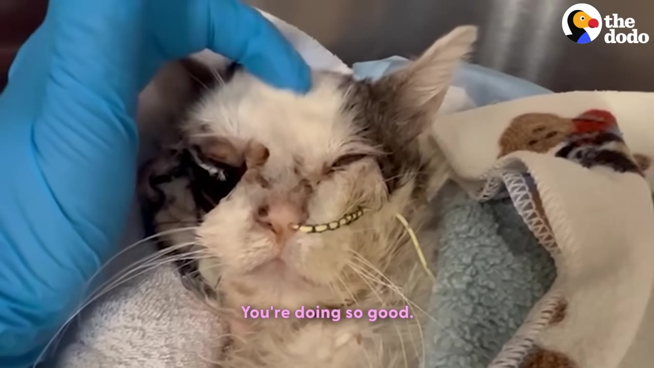 A close-up of an injured white and grey cat named Duke lying down wrapped in blankets, with a medical tube in his nose, being gently petted on the head by a person wearing a blue medical glove.