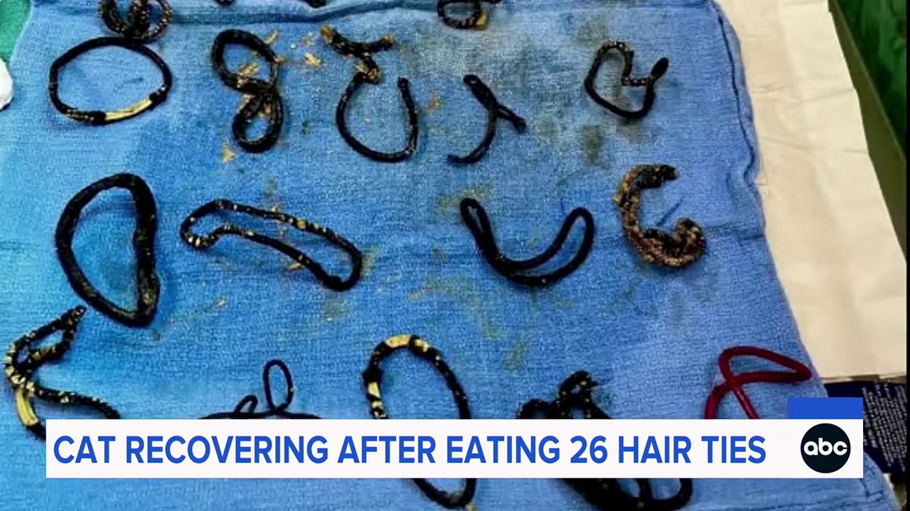 Several dirty, dark hair ties laid out on a blue surgical towel.