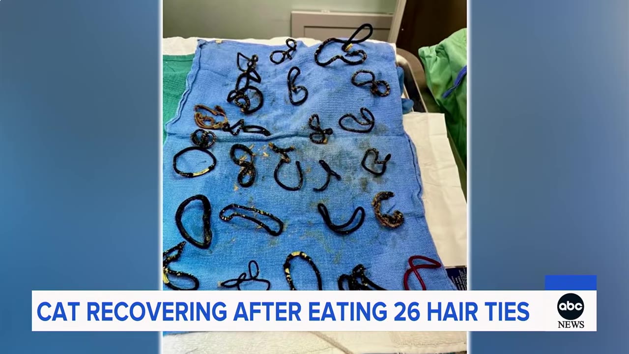 Dozens of black hair ties laid out on a blue surgical towel.