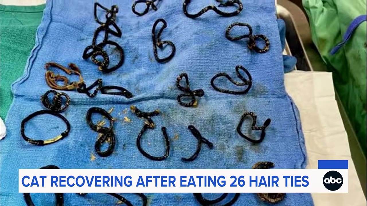 A collection of dark, elastic hair ties laid out on a blue surgical towel.
